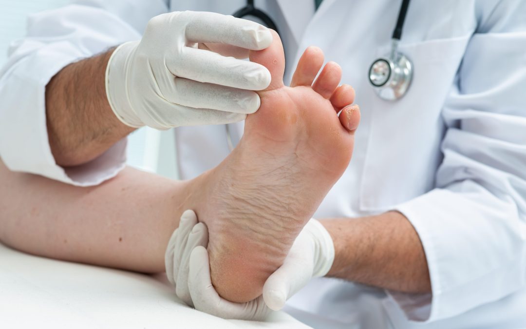Fast Recovery Tips for Ankle Sprain Treatment in Chesapeake, VA That Reduce Your Downtime