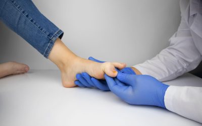 Your Guide to Pain-Free Walking Through Bunion Treatment in Abingdon, MD