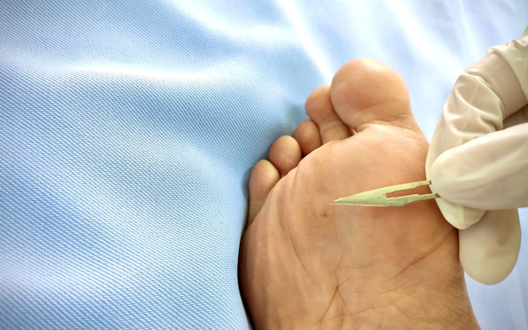 Common Foot Issues a Podiatrist in Cypress, TX, Treats and How You Benefit