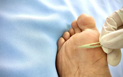 Common Foot Issues a Podiatrist in Cypress, TX, Treats and How You Benefit